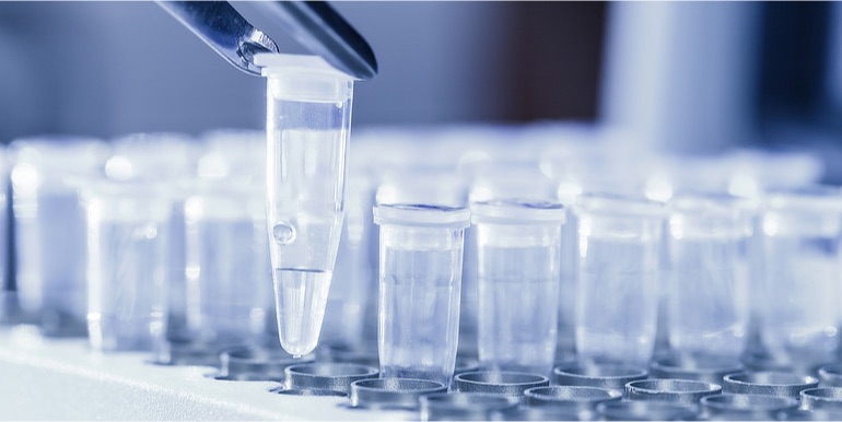 Jakou roli hraje test HPV v cervikálním screeningu?