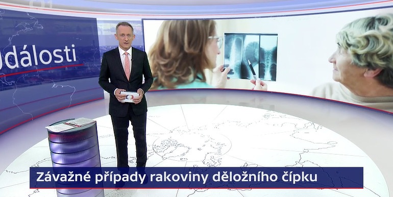 Závažné případy rakoviny děložního čípku